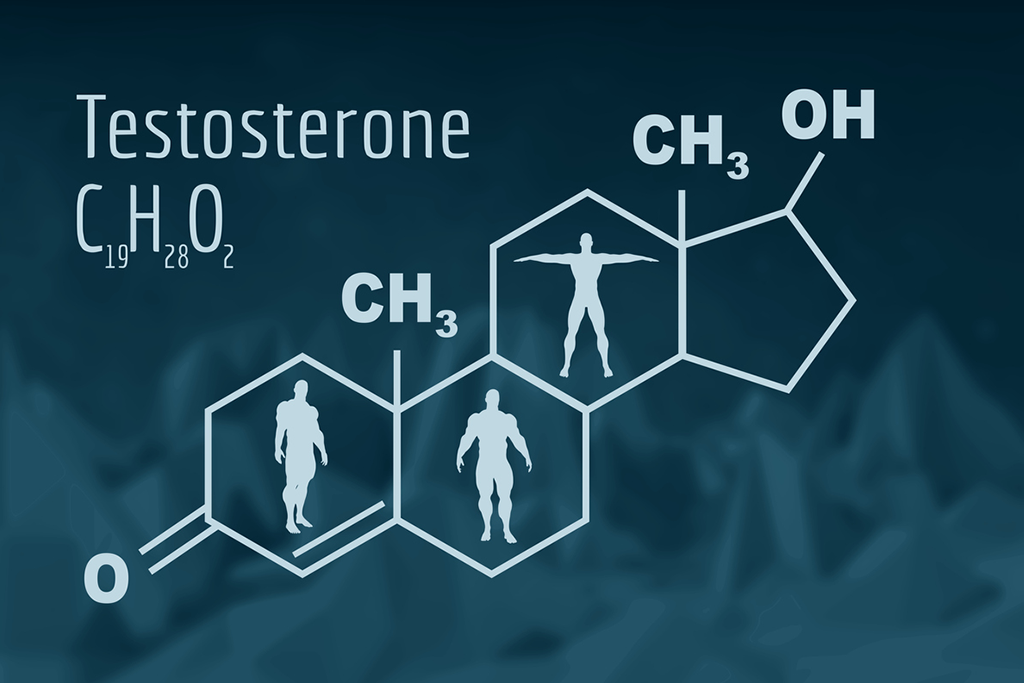 TRT Pellet Press Machine